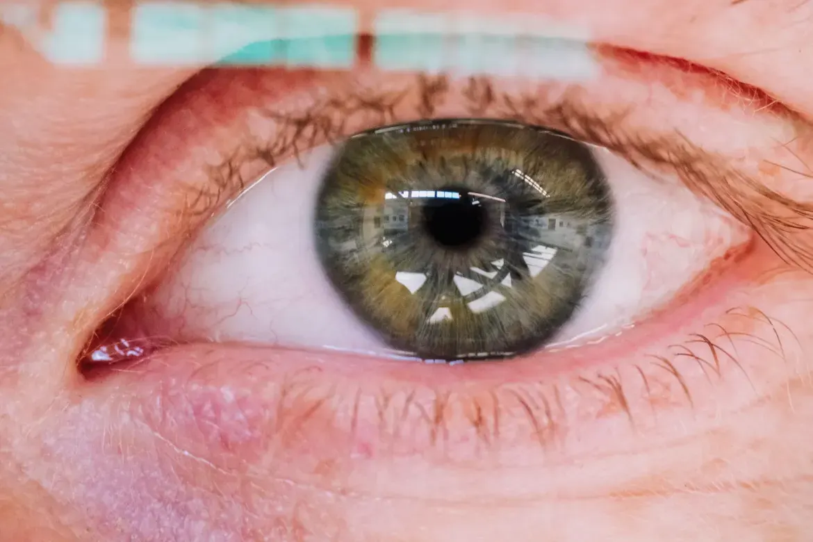 A close-up of a green eye